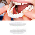Guili | Removable Smile Veneers for Upper and Lower Teeth