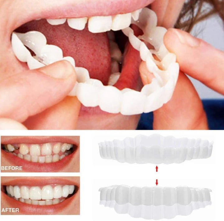 Guili | Removable Smile Veneers for Upper and Lower Teeth